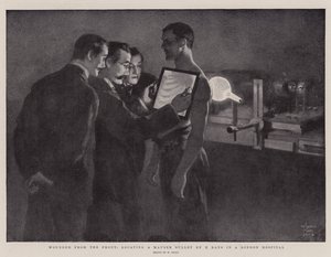 Gewonden van het Front, lokaliseren van een Mauser Kogel met Röntgenstralen in een Londens Ziekenhuis door William Small