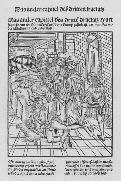 Het boek van Cirurgia door Hieronymus Brunschwig door (after) German School