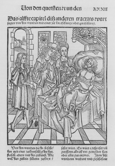 Het boek van Cirurgia door Hieronymus Brunschwig door (after) German School