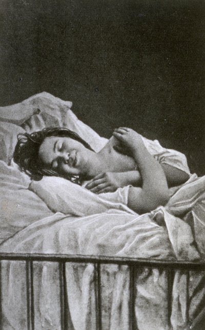 Jonge vrouw met een aanval van hysterie, 1878 door Albert Londe