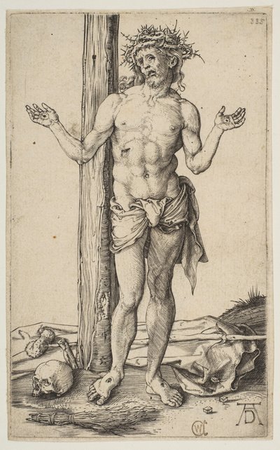 Man van Smarten met Uitgestrekte Armen door Albrecht Dürer