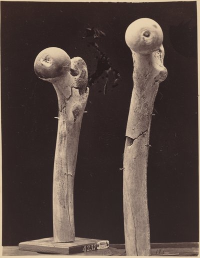Exemplaren van schotbreuken van het dijbeen, c. 1867 (foto) door American Photographer