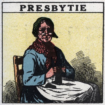 Het oog: persoon met presbyopie. Anonieme illustratie uit 1925. Privécollectie. door Anonymous Anonymous