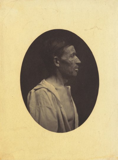 Een portret, in profiel gezien, van een man van 42 jaar, verdoofd door alcoholmisbruik..., 1854-1856 door Duchenne de Boulogne