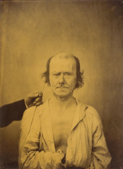 Aandacht links, Reflectie rechts, 1854-1856, gedrukt 1862. door Duchenne de Boulogne