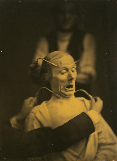 Uitdrukking van terreur, 1854-1856, gedrukt 1862 door Duchenne de Boulogne