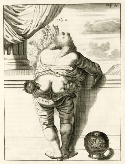 Een voorbeeld van koppen, uit Exercitationes Practicae circa Medendi Methodum door Frederik Dekkers, 1694 door Dutch School