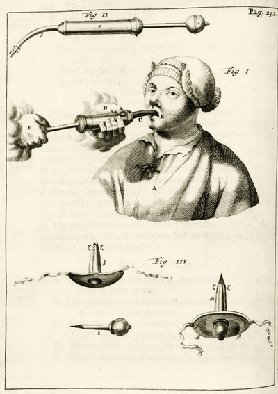 Gebruik van een spuit om een purgeermiddel toe te dienen, uit Exercitationes Practicae circa Medendi Methodum door Frederik Dekkers, 1694 door Dutch School
