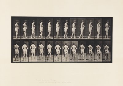 Plaat 542. Meervoudige Cerebro-Spinale Sclerose - Lopen door Eadweard Muybridge