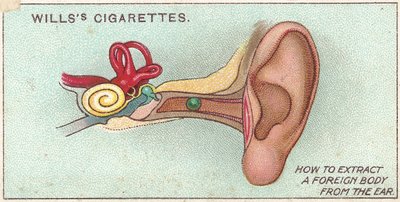 Vreemd lichaam in oor, nr. 30 uit de Eerste Hulp-serie van Willss cigarettes kaarten door English School