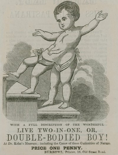 Levende twee-in-één, of dubbel-lichamige jongen door English School