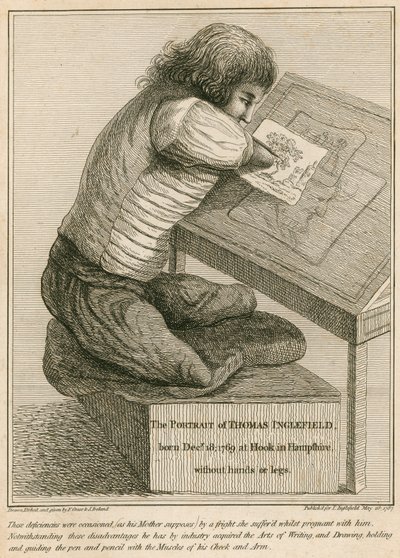 Thomas Inglefield, geboren 18 december 1769 in Hook, Hampshire, zonder armen of benen door English School
