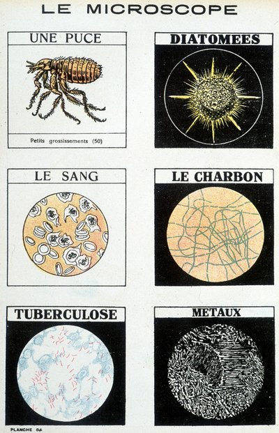 Microscopen: een chip, diatomeeën, bloed, steenkool, tuberculose, metalen door French School