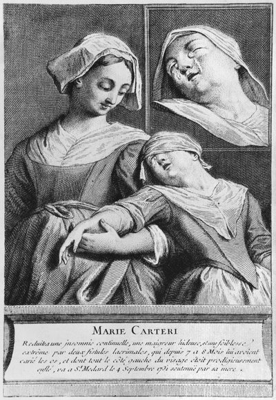 Wonderbaarlijke genezing van een blinde vrouw, Marie Carteri, op het graf van Diaken François de Paris op de parochiebegraafplaats Saint-Médard in Parijs door French School