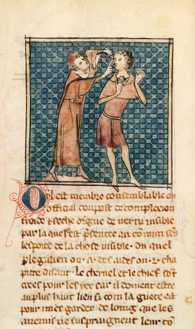 Ms 2030 fol.17 Oogheelkunde, illustratie uit La Chirurgie de Maître Henri de Mondeville door French School