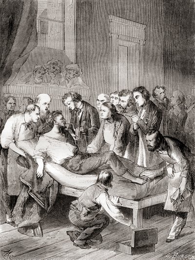 De eerste openbare demonstratie van het gebruik van ingeademde ether als chirurgisch anestheticum in 1846 door een Amerikaanse tandarts, William Thomas Green Morton, uit 
