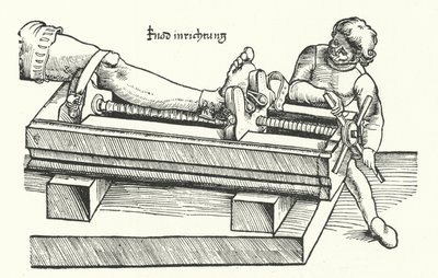 Apparaat voor het rechtzetten van een gewonde been (gravure) door German School