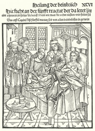 Dokters aan het bed van een man met een gebroken been (gravure) door German School