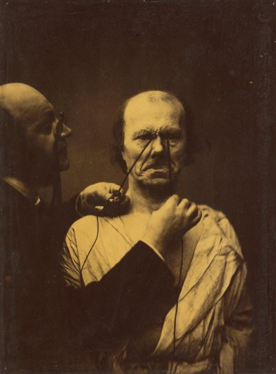 Agressie, boosaardigheid,1854-1856, gedrukt 1862 (foto) door Guillaume-Benjamin-Armand Duchenne de Boulogne