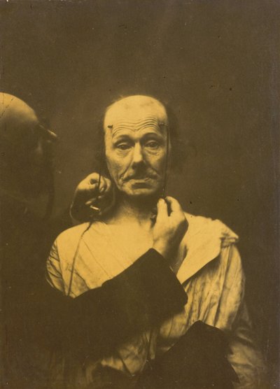Aandacht,1854-1856, gedrukt 1862 (foto) door Guillaume-Benjamin-Armand Duchenne de Boulogne
