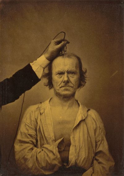 Aandacht (links); Ernst, agressie (rechts),1854-1856, gedrukt 1862 (foto) door Guillaume-Benjamin-Armand Duchenne de Boulogne