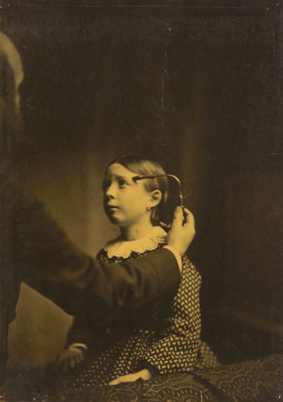 Pijnlijke herinneringen,1854-1856, gedrukt 1862 (foto) door Guillaume-Benjamin-Armand Duchenne de Boulogne
