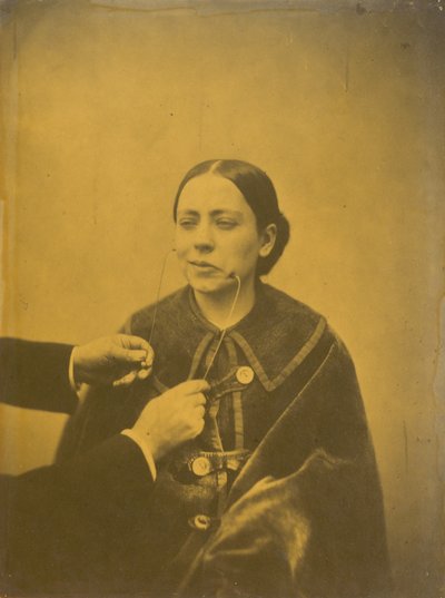 Verachtelijke afkeer (links); Verachtelijk lachen (rechts),1854-1856, gedrukt 1862 (foto) door Guillaume-Benjamin-Armand Duchenne de Boulogne