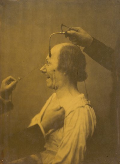 De aandacht getrokken door een voorwerp dat wulpse ideeën en verlangens opwekt,1854-1856, gedrukt 1862 (foto) door Guillaume-Benjamin-Armand Duchenne de Boulogne