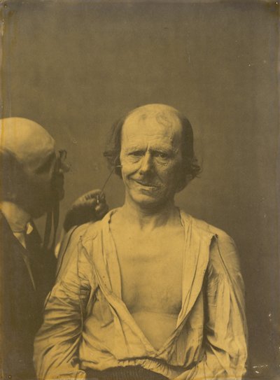 Een ontspannen gezicht (links); Valse vreugde of lach (rechts),1854-1856, gedrukt 1862 (foto) door Guillaume-Benjamin-Armand Duchenne de Boulogne