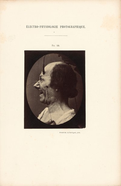 Fotografische elektrofysiologie, Afbeelding 39 door Guillaume Benjamin Duchenne