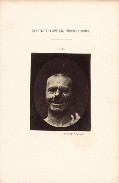 Fotografische elektrofysiologie, Afbeelding 53 door Guillaume Benjamin Duchenne