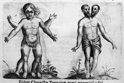 Verschillende soorten menselijke monsters. Gravure uit 