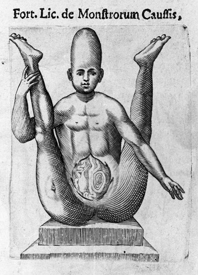 Menselijk monster: een wezen met een enorme schedel, met zichtbare ingewanden. Gravure uit 