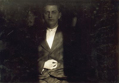 Frank Wiegel uit Brooklyn, gewond na 18 uur per dag werken op 15-jarige leeftijd, twee vingers werden van zijn rechterhand geamputeerd, New York city door Lewis Wickes Hine