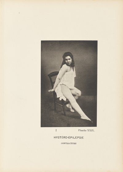Hystero-epilepsie contractuur door Paul Marie Léon Regnard