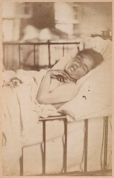 Hysterische epilepsie, permanente contractie, plaat XXVIII uit 