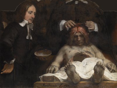 De anatomische les van Dr. Jan Deyman, 1656 door Rembrandt van Rijn