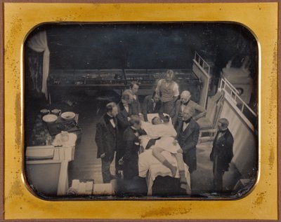Gebruik van ether voor anesthesie door Southworth and Hawes