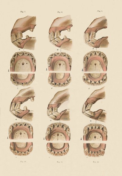 Beschrijving van plaat die de leeftijd aangeeft, zoals aangegeven door de tanden, c1879 door Unbekannt