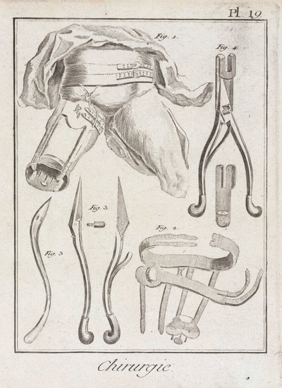 Vroege moderne orthopedische chirurgie door Unbekannt