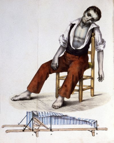Patiënt met cholera door Unbekannter Künstler