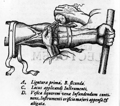 Anatomische plaat: verschillende ligaturen. Werk over het bloedsysteem door William Harvey (1578-1657), Engelse arts. Hij beschreef de bloedsomloop in het lichaam via de aderen door Unknown artist