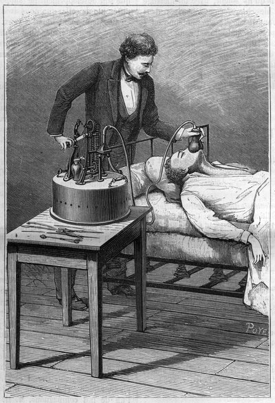 Apparaat van dokter Dubois voor anesthesie door de titel mengsels van chloroform en lucht (Methode van Paul Bert). Gravure uit 1885. door Unknown artist