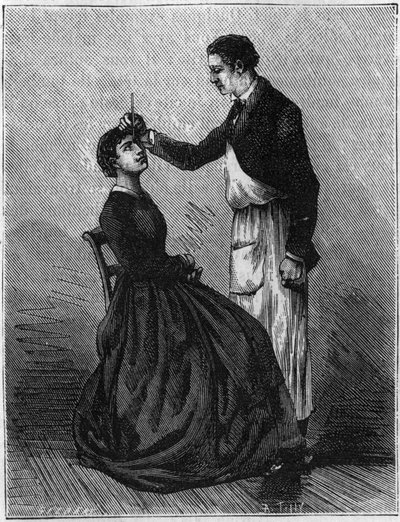 Hypnotisme verschijnselen: Hypnotisme geproduceerd door het fixeren van een potloodhouder tussen de ogen. Gravure uit 1881. door Unknown artist