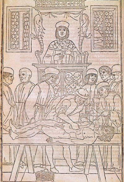 Autopsie. Codex. Het lichaam van een dode man ontleed door artsen voor een anatomische studie. 
