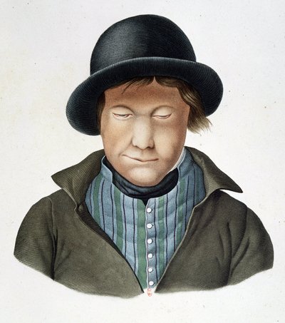 Lepers van IJsland, circa 1840 door Unknown artist