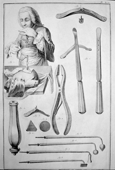Schedeltrepanatie, diverse instrumenten door Unknown artist
