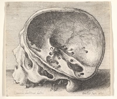 Gesecteerde schedel in profiel naar links met de linkerzijde van de schedel verwijderd, 1651 door Wenceslaus Hollar