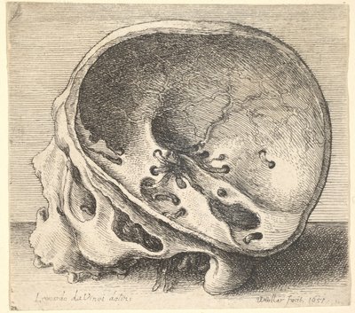 Gesneden schedel in profiel naar links met de linkerzijde van de schedel verwijderd, 1651 door Wenceslaus Hollar
