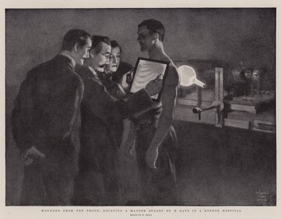 Gewonden van het Front, lokaliseren van een Mauser Kogel met Röntgenstralen in een Londens Ziekenhuis door William Small